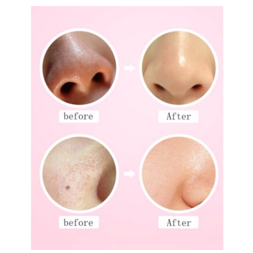 4D Soft Hair Washing Brush Cleansing Brush Massage Pore Cleanser Facial