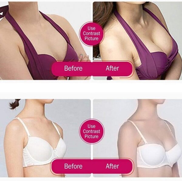 183721 Shu Teng Breast Enhancement Instrument