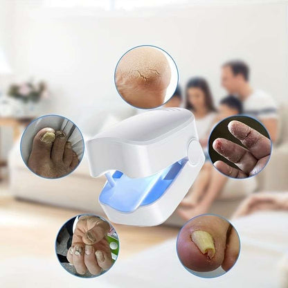1-Pack Nail Fungus Cleaner UV Sterilizer